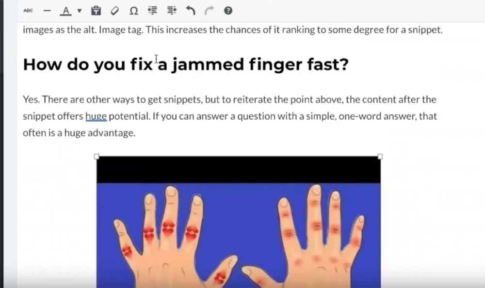 How To Fix A Jammed Finger Quickly